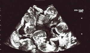 gemelli