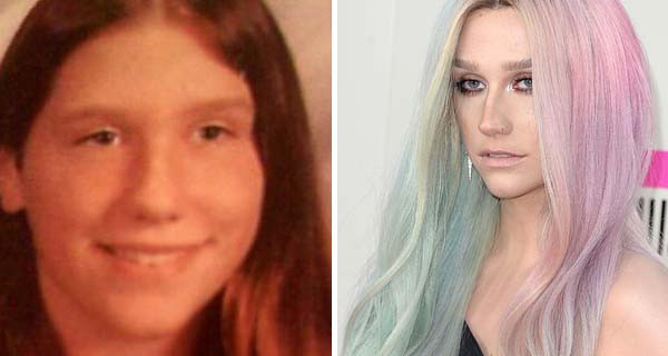 Kesha