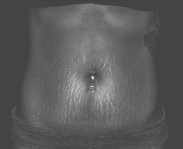Instagram: #loveyourlines Ama Il Tuo Corpo, Imperfezioni Comprese!