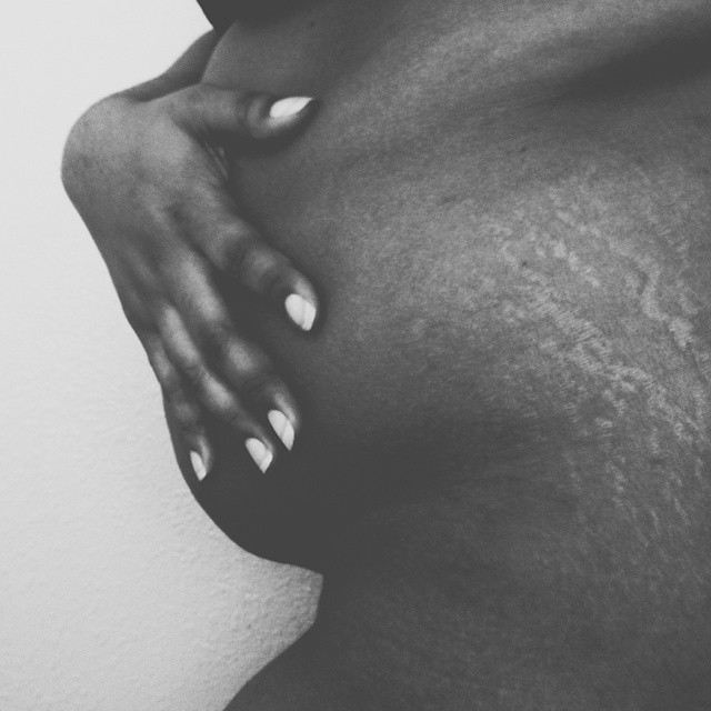 Instagram: #loveyourlines Ama Il Tuo Corpo, Imperfezioni Comprese!