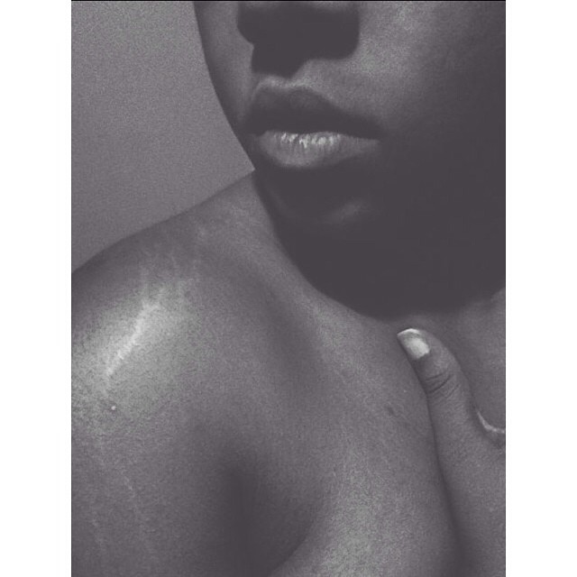 Instagram: #loveyourlines Ama Il Tuo Corpo, Imperfezioni Comprese!