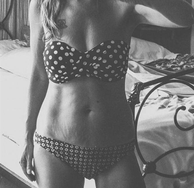 Instagram: #loveyourlines Ama Il Tuo Corpo, Imperfezioni Comprese!