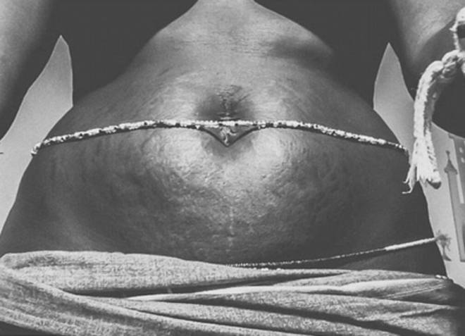 Instagram: #loveyourlines Ama Il Tuo Corpo, Imperfezioni Comprese!