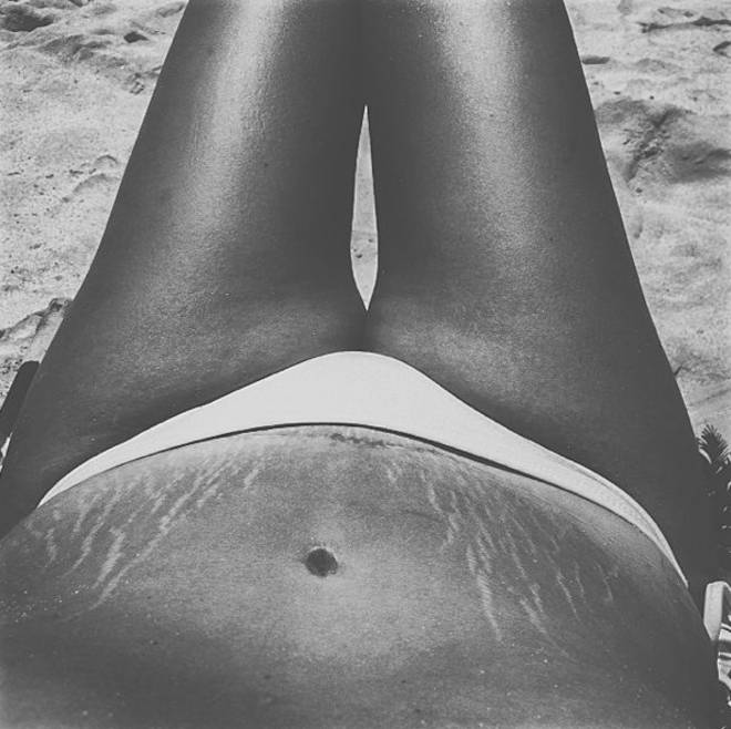 Instagram: #loveyourlines Ama Il Tuo Corpo, Imperfezioni Comprese!