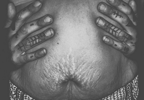 Instagram: #loveyourlines Ama Il Tuo Corpo, Imperfezioni Comprese!