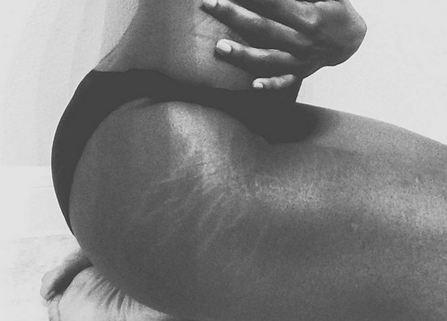 Instagram: #loveyourlines Ama Il Tuo Corpo, Imperfezioni Comprese!