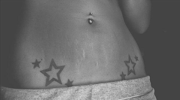 Instagram: #loveyourlines Ama Il Tuo Corpo, Imperfezioni Comprese!