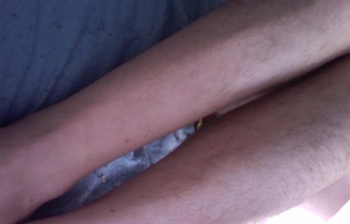 (foto: HairyLegsClub)