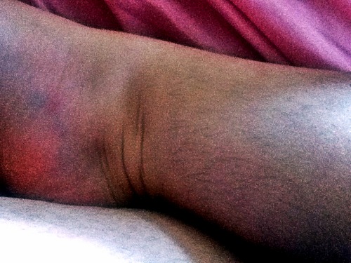 (foto: HairyLegsClub)