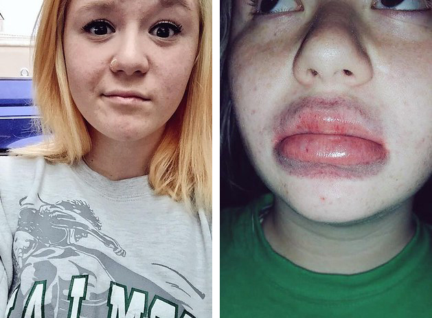 Labbra più Carnose con Questo Trucco: Ma sono Anche più Belle?