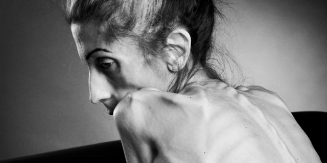 rachel farrokh anoressia
