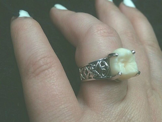 anello fidanzamento dente