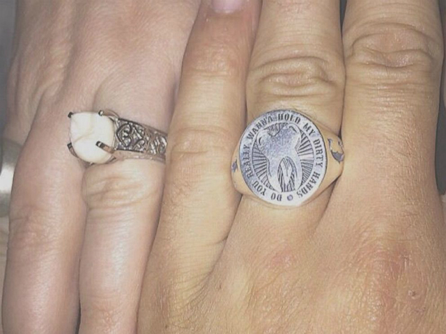 anello fidanzamento dente
