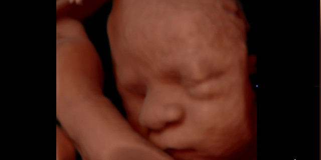 Viso del bambino in un'ecografia 3D