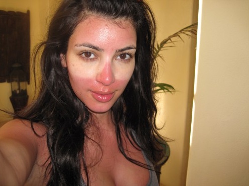 Kimberly-Noel-Kardashian-Sunburn
