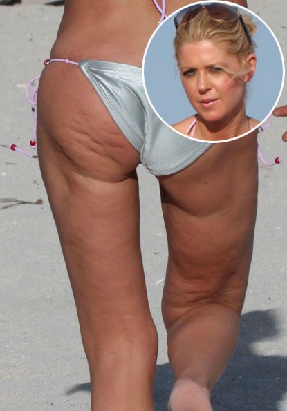 tara-reid-bikini-cellulite